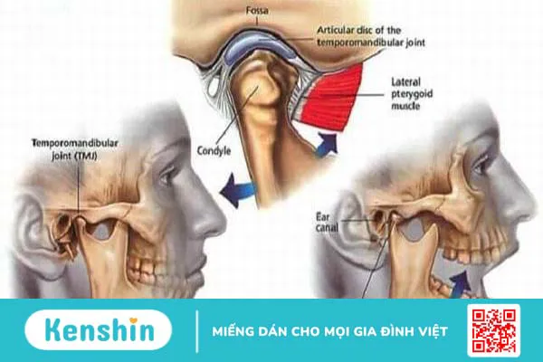 Hiểu rõ về hiện tượng sái quai hàm