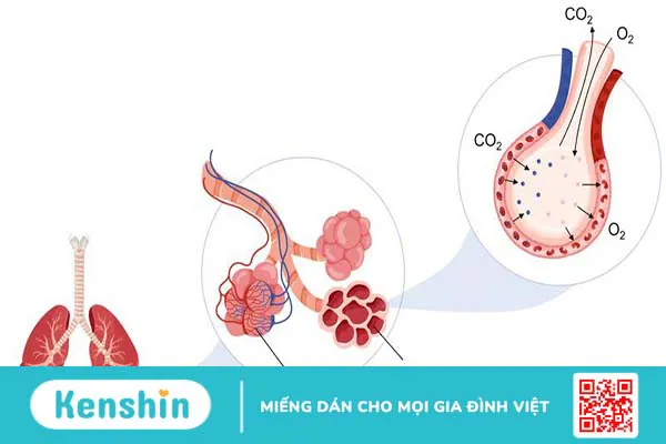 Hình thể ngoài, cấu trúc của nhu mô phổi và các bệnh lý liên quan thường gặp