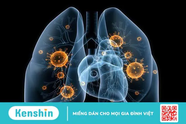 Hình thể ngoài, cấu trúc của nhu mô phổi và các bệnh lý liên quan thường gặp