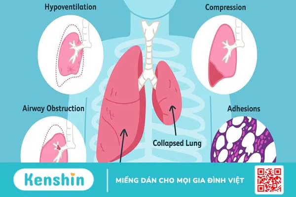 Hình thể ngoài, cấu trúc của nhu mô phổi và các bệnh lý liên quan thường gặp