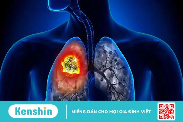 Hình thể ngoài, cấu trúc của nhu mô phổi và các bệnh lý liên quan thường gặp