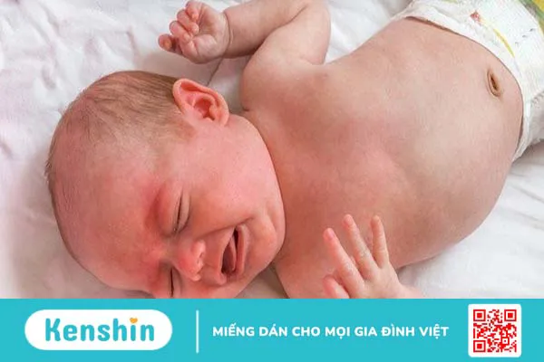 Hội chứng Alagille là gì? Những điều cần biết