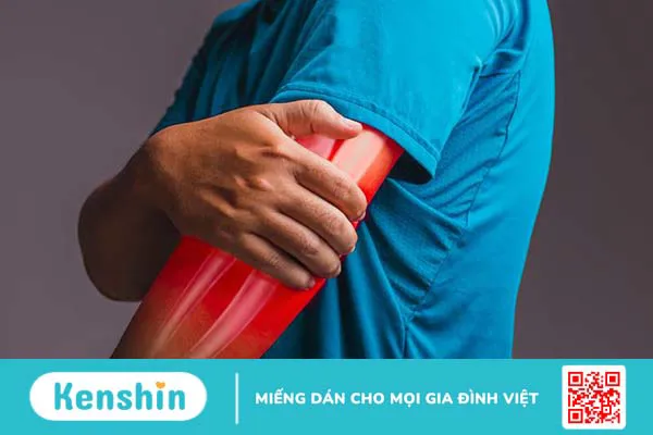 Hội chứng Tennis Elbow là gì? Cách điều trị hiệu quả nhất