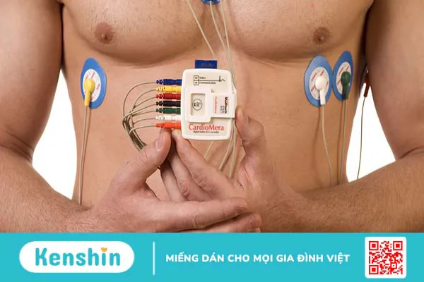 Holter điện tâm đồ: Ý nghĩa và lợi ích đối với bệnh tim