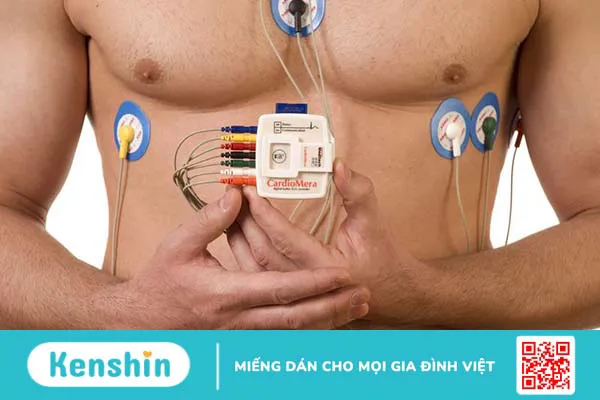 Holter điện tâm đồ: Ý nghĩa và lợi ích đối với bệnh tim