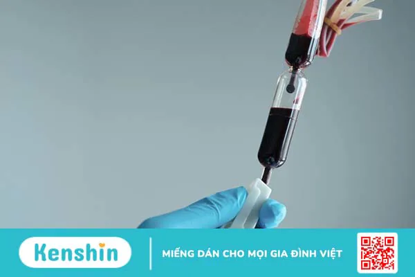 Hồng cầu nghèo bạch cầu là gì? Khi nào cần sử dụng hồng cầu nghèo bạch cầu?