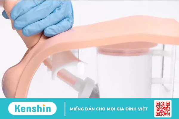 Hướng dẫn cách đặt ống thông tiểu nam