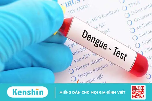 Hướng dẫn cách đọc chỉ số xét nghiệm máu sốt xuất huyết