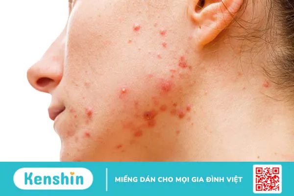 Hướng dẫn kết hợp Retinol và BHA để chăm sóc da đúng cách 2