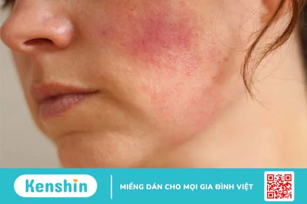 Hướng dẫn kết hợp Retinol và BHA để chăm sóc da đúng cách 3