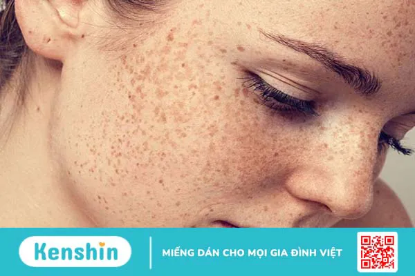 Hướng dẫn mẹ bỉm chăm sóc da mặt sau sinh