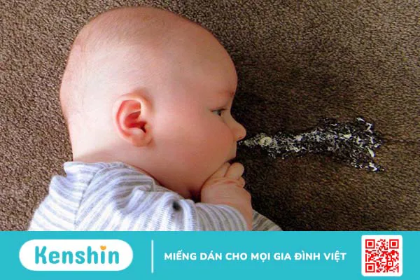 Hướng dẫn mẹ cách chăm sóc trẻ bị dị ứng đạm sữa bò 3