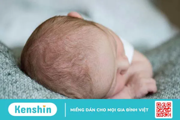 Hướng dẫn phân biệt bướu máu và bướu huyết thanh