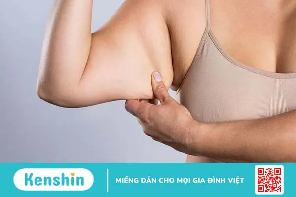 Hút mỡ nách bao nhiêu tiền? Tìm hiểu chi tiết về phương pháp hút mỡ nách 2