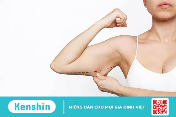 Hút mỡ nách bao nhiêu tiền? Tìm hiểu chi tiết về phương pháp hút mỡ nách 3