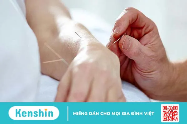 Huyệt Chi Câu là gì? Cách châm cứu huyệt Chi Câu