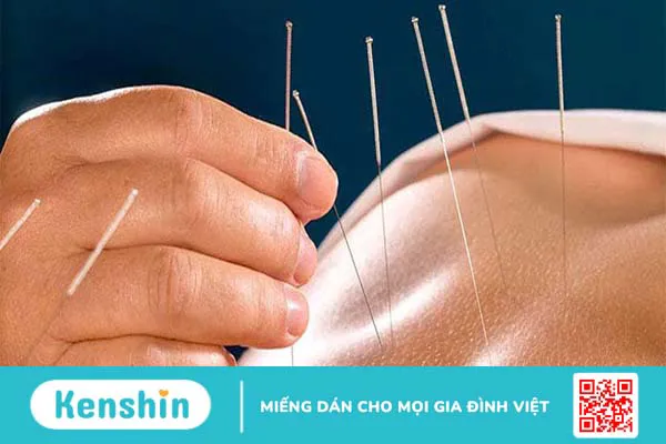 Huyệt Hiệp Bạch - Huyệt vị quan trọng giải quyết nhiều bệnh