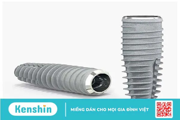 Implant sic là gì? Trồng răng implant sic có tốt không? 1