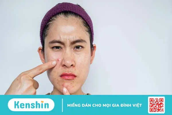 Kem chống nắng dành cho da dầu mụn La Roche-Posay Anthelios Uvmune 400