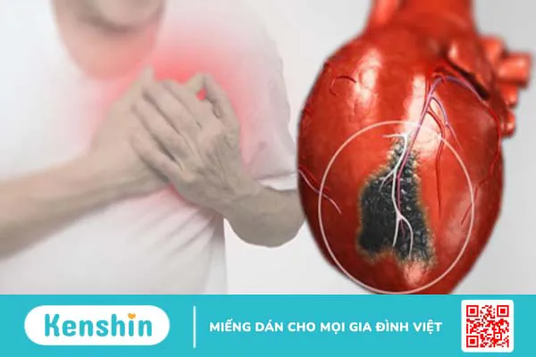 Kênh nhĩ thất được chia làm mấy loại? Các biện pháp phòng ngừa hiệu quả 4