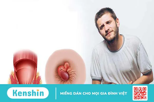 Khám bệnh trĩ là khám những gì? Review quy trình khám bệnh