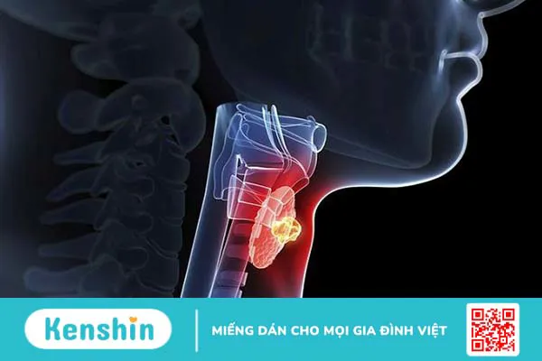 Khám tuyến giáp diễn ra như thế nào? Khi nào cần khám tuyến giáp?