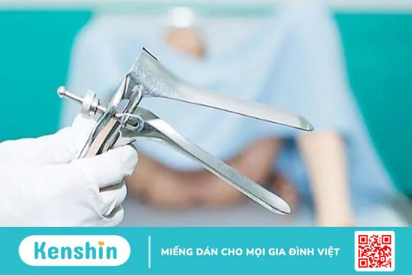 Khi nào cần khám phụ khoa bằng mỏ vịt? 2