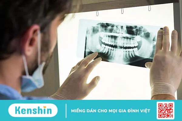 Khi nào cần thực hiện cắt chóp răng?