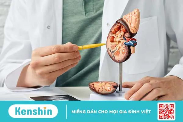 Sỏi thận có tự đào thải được không? Khi nào nên tán sỏi thận? 2