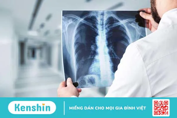 Khí quản: Vị trí, chức năng và các căn bệnh liên quan