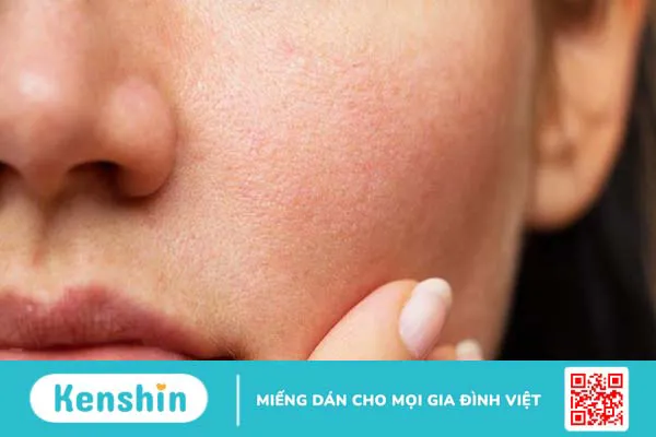 Khoá ẩm là gì? Những điều cần biết về khoá ẩm 2