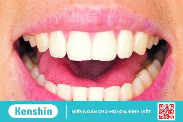 Khoang miệng: Cấu tạo, chức năng và các bệnh lý thường gặp 2