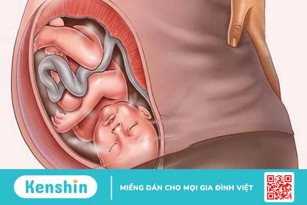 Không có màng trinh bẩm sinh có ảnh hưởng đến sức khỏe sinh sản không?