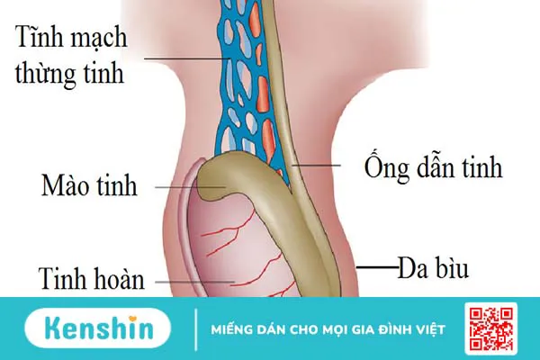 Không có ống dẫn tinh bẩm sinh: Nguyên nhân, biểu hiện và điều trị bệnh