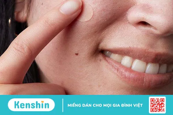 Không còn lo mụn với Miếng dán mụn ban ngày Derma Angel 2