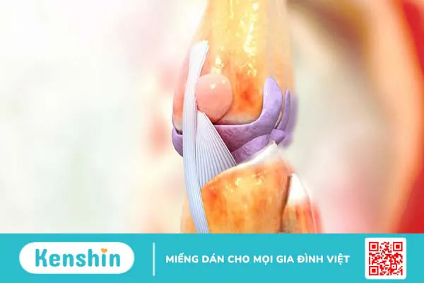 Khớp gối và các vấn đề thường gặp 2