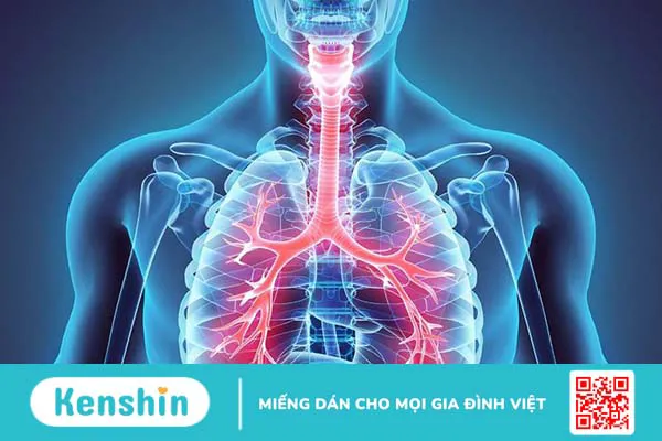 Kỹ thuật dẫn lưu tư thế thực hiện như thế nào?