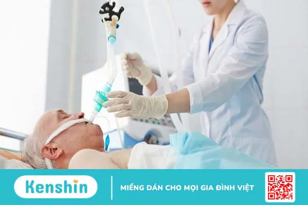 Kỹ thuật đặt ống nội khí quản 2 nòng là gì?