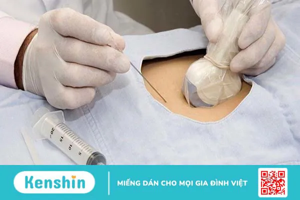 Làm gì khi độ mờ da gáy cao nhưng chọc ối bình thường?