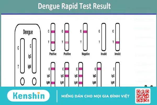 Làm thế nào để chẩn đoán sốt xuất huyết?