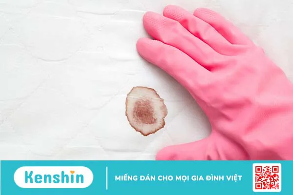 Làm thế nào để không bị tràn băng khi ngủ?