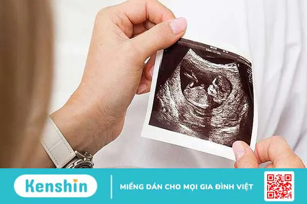 Làm xét nghiệm double test có biết được trai hay gái không?3