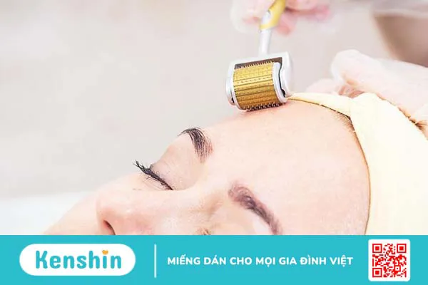 Lăn kim bao nhiêu tiền? 1