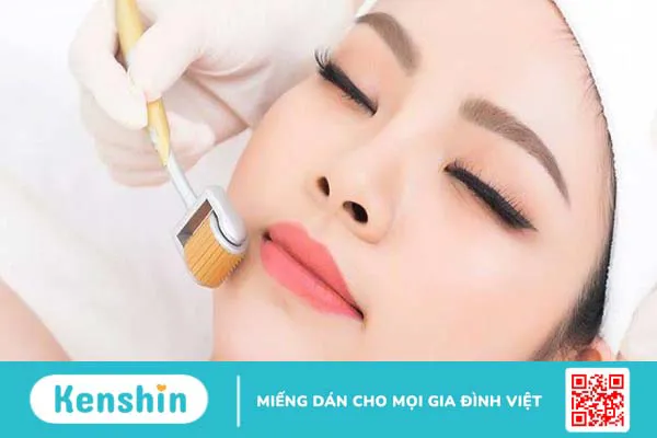 Lăn kim bao nhiêu tiền? 2