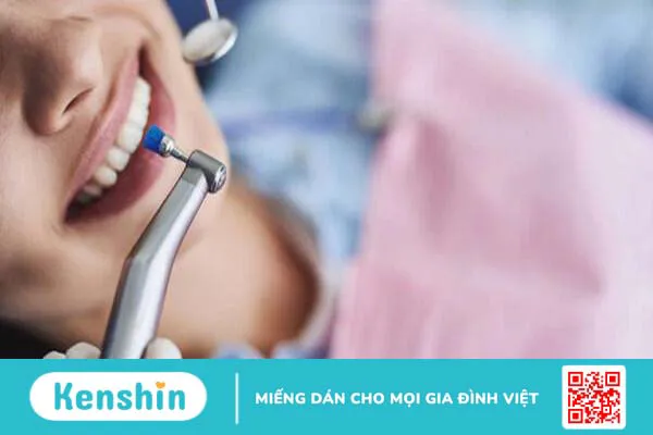 Lấy cao răng bằng máy siêu âm: Ưu điểm, quy trình và những lưu ý cần biết 4