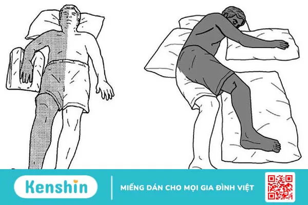 Liệt mềm cấp tính là gì? Phòng ngừa liệt mềm cấp tính như thế nào?