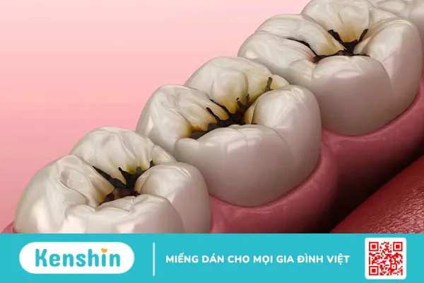 Liệu răng đang đau có nhổ được không?