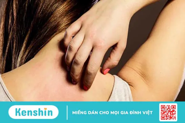 Loại cá nào dễ gây dị ứng nhất và cách xử lý