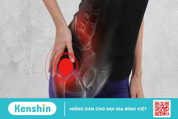 Loạn sản sợi xương: Nguyên nhân, triệu chứng và điều trị 2