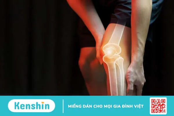 Loạn sản xơ xương: Nguyên nhân, các phương pháp chẩn đoán và điều trị 1